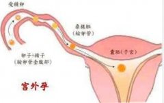 鷿ʹ
